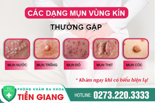 Âm Đạo Nổi Mụn Có Nguy Hiểm Không? Nguyên Nhân & Cách Điều Trị