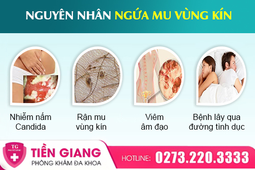 Ngứa Mu Vùng Kín Là Bệnh Gì? Những Nguyên Nhân Thường Gặp