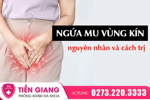 Ngứa Mu Vùng Kín Là Bệnh Gì? Những Nguyên Nhân Thường Gặp
