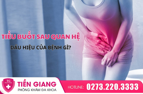 Tiểu buốt sau quan hệ là dấu hiệu của nhiều bệnh lý phụ khoa.